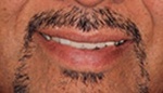 Closeup of flawed smile