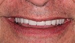Closeup of healhty properly aligned smile
